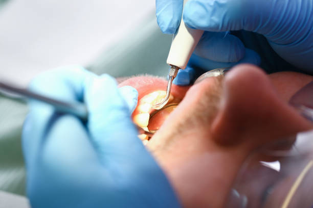 Best Pediatric Emergency Dentist in Algona, WA