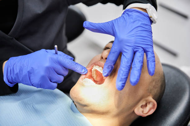 Best Emergency Dental Care for Broken or Chipped Teeth in Algona, WA